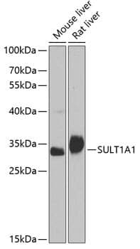 Anti-SULT1A1 Antibody