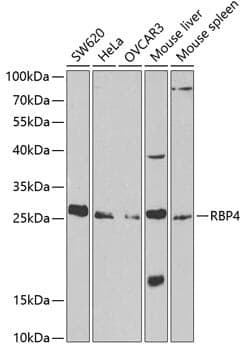 Anti-RBP4 Antibody