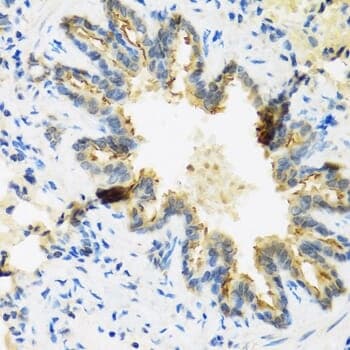 Anti-DEFB4A Antibody
