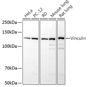 Anti-VCL Antibody