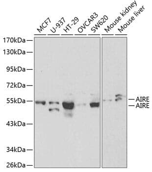 Anti-AIRE Antibody