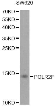 Anti-POLR2F Antibody