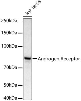 Anti-AR Antibody