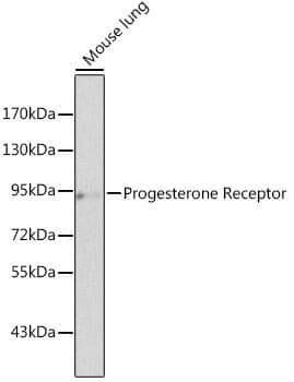 Anti-PGR Antibody