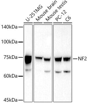Anti-NF2 Antibody