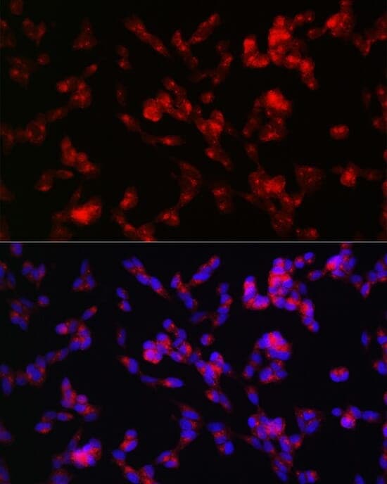 Anti-ADAMTS4 Antibody