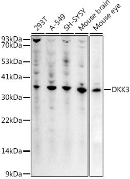 Anti-DKK3 Antibody