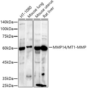 Anti-MMP14 Antibody