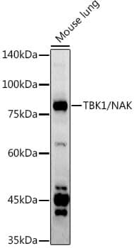 Anti-TBK1 Antibody