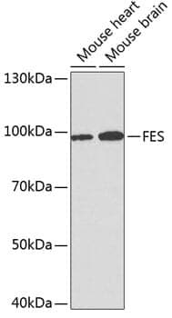 Anti-FES Antibody