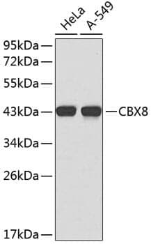Anti-CBX8 Antibody