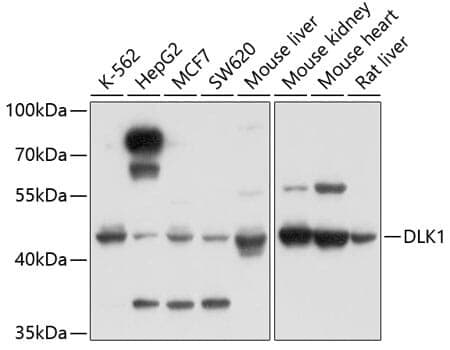 Anti-DLK1 Antibody
