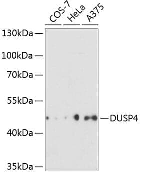 Anti-DUSP4 Antibody