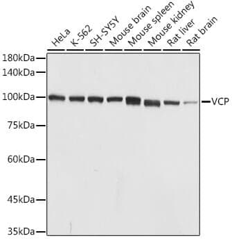 Anti-VCP Antibody