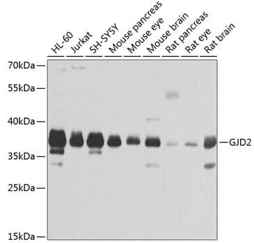 Anti-GJD2 Antibody