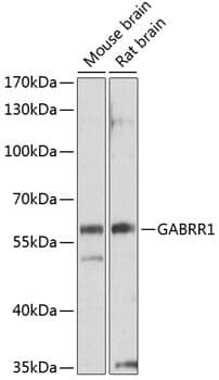 Anti-GABRR1 Antibody