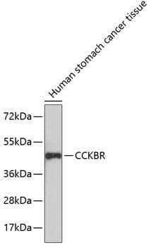 Anti-CCKBR Antibody