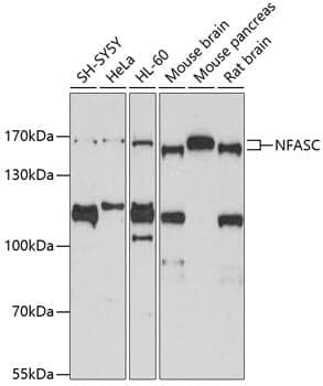 Anti-NFASC Antibody