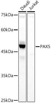 Anti-PAX5 Antibody