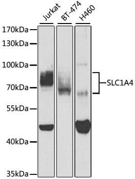 Anti-SLC1A4 Antibody