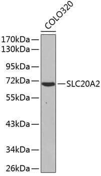 Anti-SLC20A2 Antibody