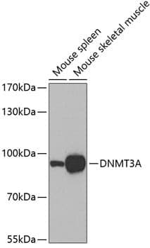 Anti-DNMT3A Antibody