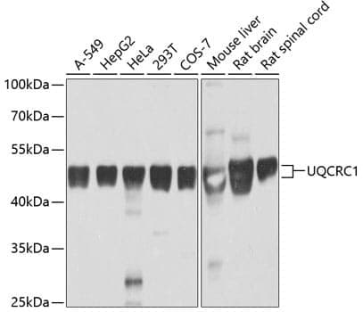 Anti-UQCRC1 Antibody