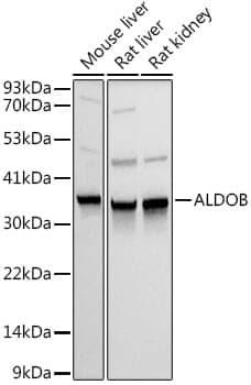 Anti-ALDOB Antibody