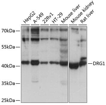 Anti-DRG1 Antibody