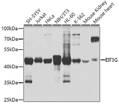 Anti-EIF3G Antibody