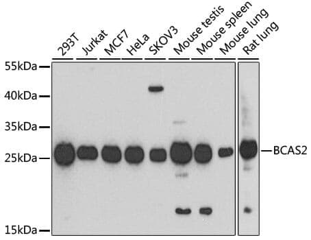 Anti-BCAS2 Antibody