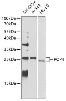 Anti-POP4 Antibody