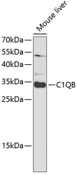 Anti-C1QB Antibody