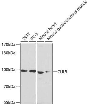 Anti-CUL5 Antibody