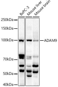 Anti-ADAM9 Antibody - Identical to Abcam (ab186833)