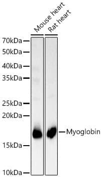 Anti-MB Antibody