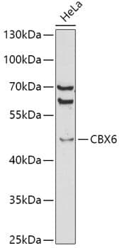 Anti-CBX6 Antibody