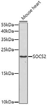 Anti-SOCS2 Antibody
