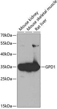 Anti-GPD1 Antibody