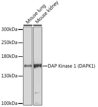 Anti-DAPK1 Antibody