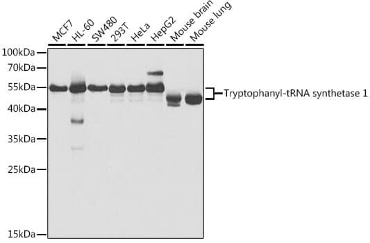 Anti-WARS Antibody