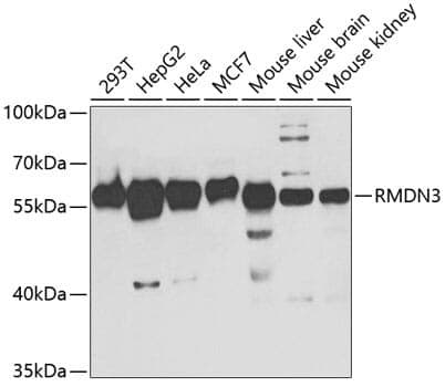 Anti-RMDN3 Antibody