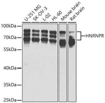 Anti-HNRNPR Antibody