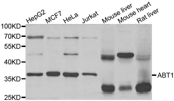 Anti-ABT1 Antibody