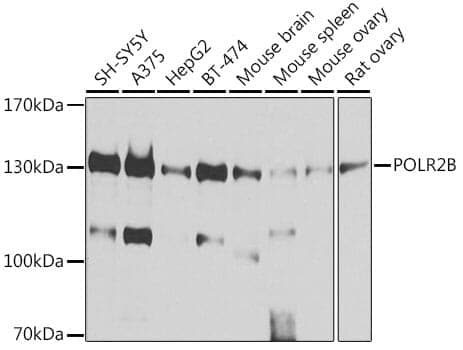 Anti-POLR2B Antibody
