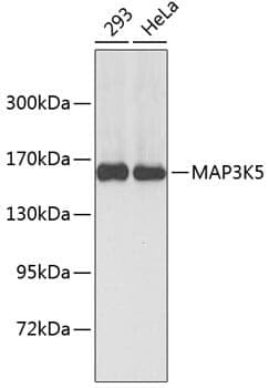 Anti-MAP3K5 Antibody