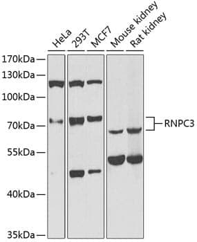 Anti-RNPC3 Antibody