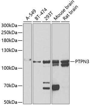 Anti-PTPN3 Antibody