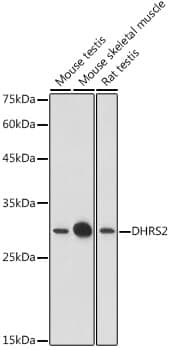 Anti-DHRS2 Antibody