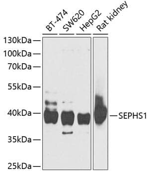 Anti-SEPHS1 Antibody